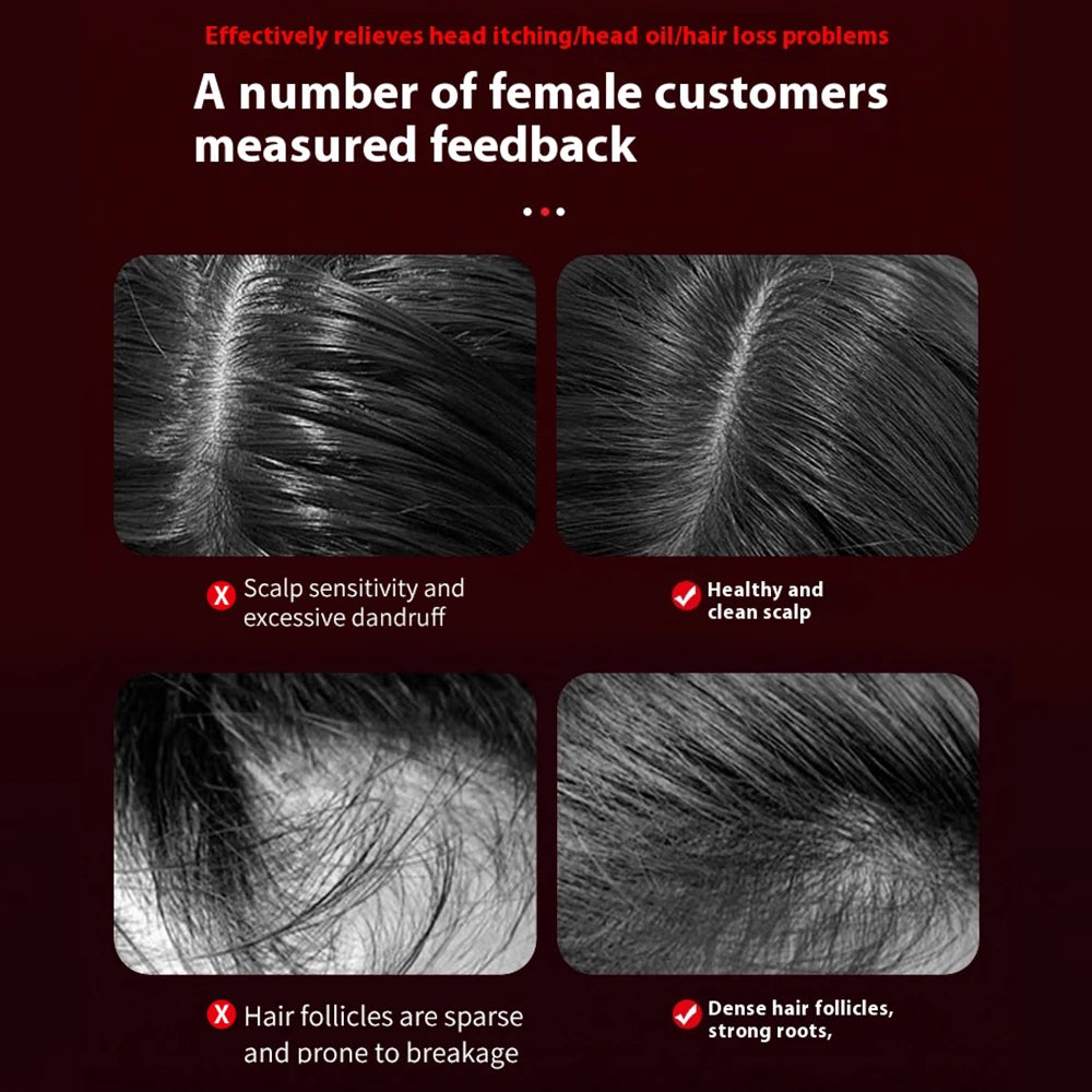 3 Modes Electric Multifunctional Infrared Therapy Comb Promote Hair Growth Massage of Hair Follicles Essence Oil Applicator